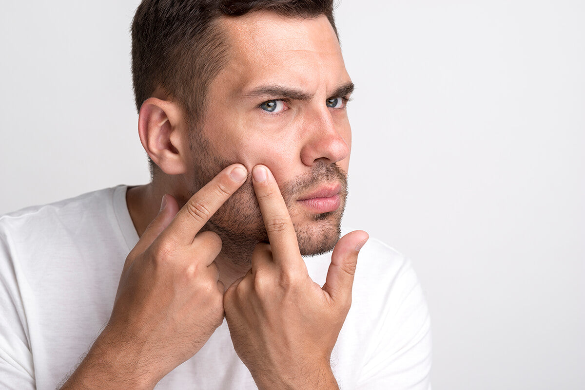 8 Skincare Ingredients To Avoid For Oily Acne-Prone Skin